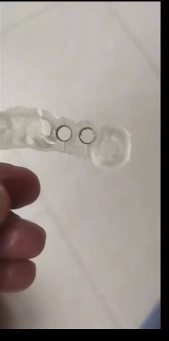 Resin Dental 3D Printer Planti - Glue For 3D Printing recension och pris